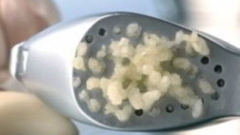 котлеты из курицы с сыром